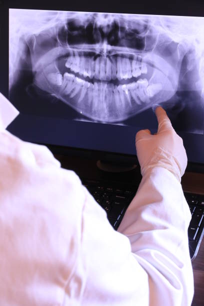 Best Emergency Root Canal Treatment in Jemison, AL